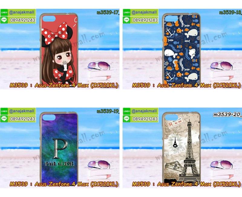 เคส ZenFone4 Max zc520kl,รับสกรีนเคสฝาพับasus zenfone4 max zc520kl,สกรีนเคสการ์ตูนasus zenfone4 max zc520kl,รับพิมพ์ลายเคส ZenFone4 Max zc520kl,เคสหนัง ZenFone4 Max zc520kl,เคสไดอารี่ ZenFone4 Max zc520kl,zenfone4 max กรอบประกบ,พิมเครชลายวันพีชพร้อมสายคล้องasus zenfone4 max zc520kl,asus zenfone4 max zc520kl กรอบยางแต่งคริสตัลสายคล้องมือ,พิมเครชการ์ตูนasus zenfone4 max zc520kl,พิมพ์เคสแข็งasus zenfone4 max zc520kl,เคสพิมพ์ลาย ZenFone4 Max zc520kl,เคสasus zenfone4 max zc520kl ลาย anime,กรอบโลหะลายการ์ตูนasus zenfone4 max zc520kl,สั่งสกรีนเคส ZenFone4 Max zc520kl,หนังasus zenfone4 max zc520kl โชว์เบอร์,พิมพ์asus zenfone4 max zc520kl ,พิมพ์เคส ZenFone4 Max zc520kl,เคสฝาพับ ZenFone4 Max zc520kl,เคสโรบอท ZenFone4 Max zc520kl,เคสซิลิโคนZenFone4 Max zc520kl,กรอบหนัง ZenFone4 Max zc520kl,asus zenfone4 max zc520kl ลายการ์ตูนวันพีช,เคสสกรีนลาย ZenFone4 Max zc520kl,เคสยาง ZenFone4 Max zc520kl onepiece,ยางนิ่มการ์ตูนasus zenfone4 max zc520kl,เคสซิลิโคนพิมพ์ลาย ZenFone4 Max zc520kl,สั่งทำการ์ตูนเคสasus zenfone4 max zc520kl,เกราะasus zenfone4 max zc520kl,เคสแข็งพิมพ์ลาย ZenFone4 Max zc520kl,asus zenfone4 max zc520kl กรอบประกบ,กรอบasus zenfone4 max zc520kl ระบายความร้อน,zenfone4 max กรอบยางนิ่มวันพีช,ยางกันกระแทกzenfone4 max,เคสยางคริสตัลติดแหวน ZenFone4 Max zc520kl,เคสบั้มเปอร์ ZenFone4 Max zc520kl,เคสประกอบ ZenFone4 Max zc520kl,เกราะasus zenfone4 max zc520kl ฝาพับ,ซองหนัง ZenFone4 Max zc520kl,ฝาครอบหลังประกบหัวท้ายasus zenfone4 max zc520kl,เคสลาย 3D ZenFone4 Max zc520kl,เกราะอลูมิเนียมเงากระจกasus zenfone4 max zc520kl,ซองหนังasus zenfone4 max zc520kl,เคสเปิดปิดasus zenfone4 max zc520kl,เคสหนังการ์ตูนasus zenfone4 max zc520kl,เคสอลูมิเนียมasus zenfone4 max zc520kl,เคสกันกระแทก ZenFone4 Max zc520kl,เคสโทรศัพท์ ZenFone4 Max zc520kl,เคสสะพายasus zenfone4 max zc520kl,กรอบหนังฝาพับasus zenfone4 max zc520kl,เคสกระจกasus zenfone4 max zc520kl,สกรีนเคสวันพีชasus zenfone4 max zc520kl,หนังโทรศัพท์ ZenFone4 Max zc520kl,เคสหนังฝาพับ ZenFone4 Max zc520kl,เคสนิ่มสกรีนลาย ZenFone4 Max zc520kl,เคสแข็ง ZenFone4 Max zc520kl,เครชzenfone4 max ประกบหน้าหลัง,กรอบ ZenFone4 Max zc520kl,เคสasus zenfone4 max zc520kl ระบายความร้อน,กรอบประกบหน้าหลังasus zenfone4 max zc520kl,เคสยางสายคล้องคอasus zenfone4 max zc520kl,ซองฝาพับasus zenfone4 max zc520kl,สกรีนดาราเกาหลีasus zenfone4 max zc520kl,พร้อมส่งเครชพิมพ์ลายasus zenfone4 max zc520kl,ซองหนังลายการ์ตูน ZenFone4 Max zc520kl,สกรีนasus zenfone4 max zc520kl,asus zenfone4 max zc520kl เครชประกบหัวท้าย,กรอบประกบหน้าหลัง ZenFone4 Max zc520kl,เคสฝาปิดการ์ตูน ZenFone4 Max zc520kl,โชว์เบอร์asus zenfone4 max zc520kl ลายการ์ตูน,เคสประกบ ZenFone4 Max zc520kl,ยางนิ่มตัวการ์ตูนasus zenfone4 max zc520kl,กรอบคริสตัลยาง ZenFone4 Max zc520kl,กรอบโทรศัพท์ ZenFone4 Max zc520kl,เคสสกรีน ZenFone4 Max zc520kl,เคสโทรศัพท์ ZenFone4 Max zc520kl,หนังฝาพับใส่เงินใส่บัตรasus zenfone4 max zc520kl,เคสประกบ ZenFone4 Max zc520kl,ฝาพับกระจกเงาasus zenfone4 max zc520kl,กรอบasus zenfone4 max zc520kl,เคสประกบปั้มเปอร์ ZenFone4 Max zc520kl,กรอบบัมเปอร์เคสasus zenfone4 max zc520kl,กรอบนิ่มติดแหวนasus zenfone4 max zc520kl,เกราะนิ่มzenfone4 max กันกระแทก,ซิลิโคนตัวการ์ตูนasus zenfone4 max zc520kl,เคส 2 ชั้น กันกระแทก ZenFone4 Max zc520kl,เคสแต่งคริสตัลยางนิ่มasus zenfone4 max zc520kl,ฝาหลังสกรีนasus zenfone4 max zc520kl,เคสโรบอทกันกระแทก ZenFone4 Max zc520kl